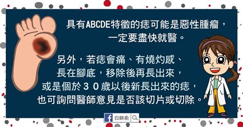 凸起來的痣|我的「痣」會是惡性腫瘤嗎？醫師告訴你：符合這5特。